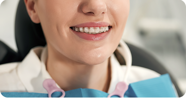 Sourire avec appareil dentaire